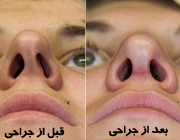 enherafebini