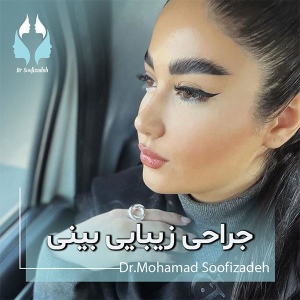 rhinoplasty-11