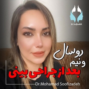 rhinoplasty-13