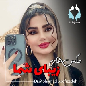 rhinoplasty-15