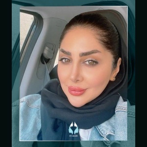rhinoplasty-19