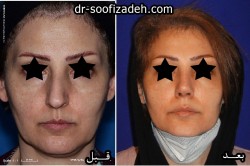 عمل دماغ دکتر صوفی زاده