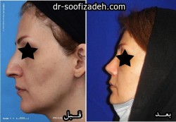 جراحی دماغ دکتر صوفی زاده