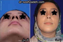 عمل دماغ