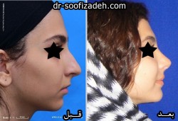 عمل دماغ