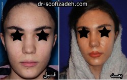 نمونه جراحی دکتر صوفی زاده