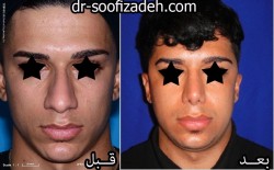 بینی طبیعی مردان دکتر صوفی زاده