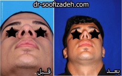 دکتر صوفی زاده بینی مردان