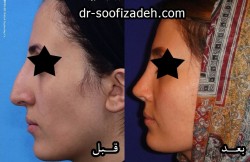 نمونه بینی انحراف دار