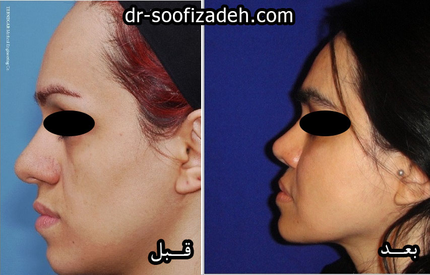 نمونه تزریقی دکتر صوفی زاده