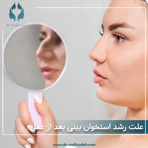 رشد استخوان بینی بعد از عمل