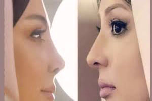 عکس قبل و بعد عمل نیوشا ضیغمی