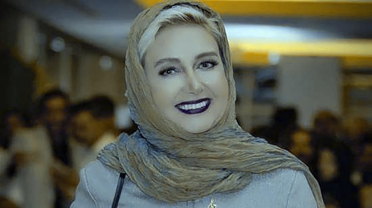 عکس قبل و بعد عمل بینی کتایون ریاحی