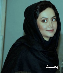 عکس بعد از عمل مریم خدارحمی