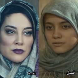 عکس قبل و بعد ا عمل آشا محرابی