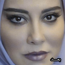 عکس بعد از عمل آشا محرابی