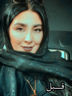 مریم معصومی قبل از عمل