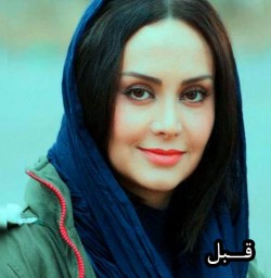 عکس قبل از عمل مریم خدارحمی