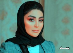 مریم معصومی بعد از عمل