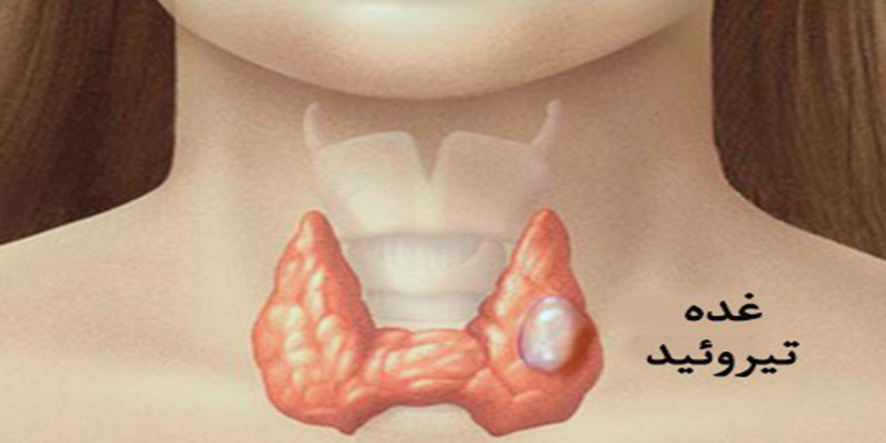 تیروئید و جراحی بینی