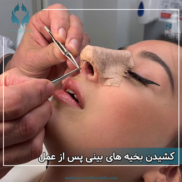کشیدن بخیه های بینی