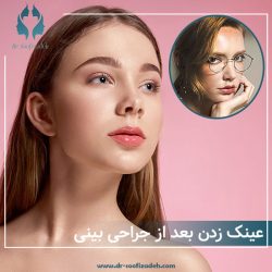 عینک زدن بعد از جراحی بینی