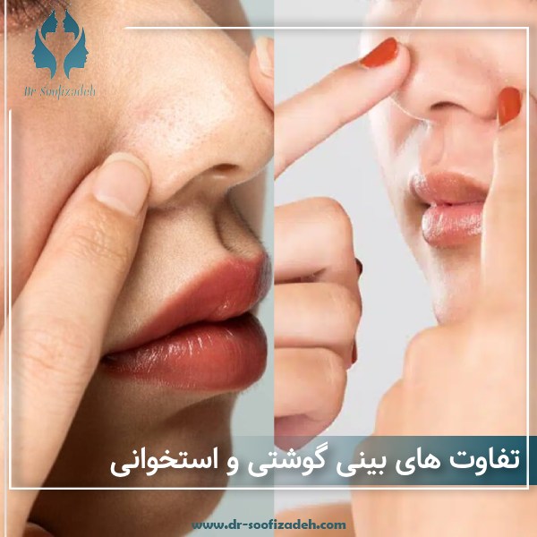 تفاوت های بینی گوشتی و استخوانی