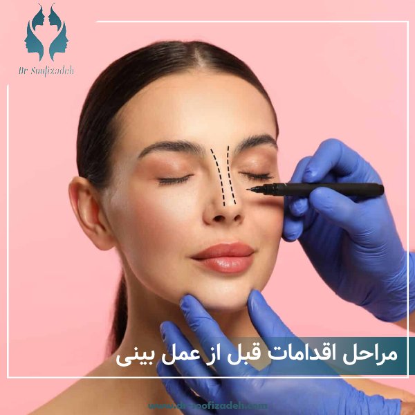 اقدامات قبل از عمل بینی