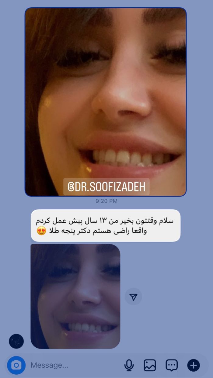 نظرات بیماران بهترین جراح بینی تهران