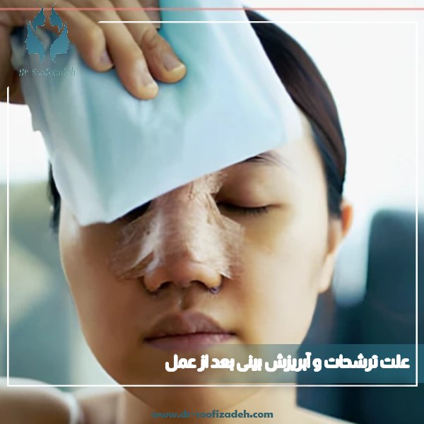 نحوه استفاده از کمپرس بعد از عمل بینی + مزایا کمپرس سرد و گرم