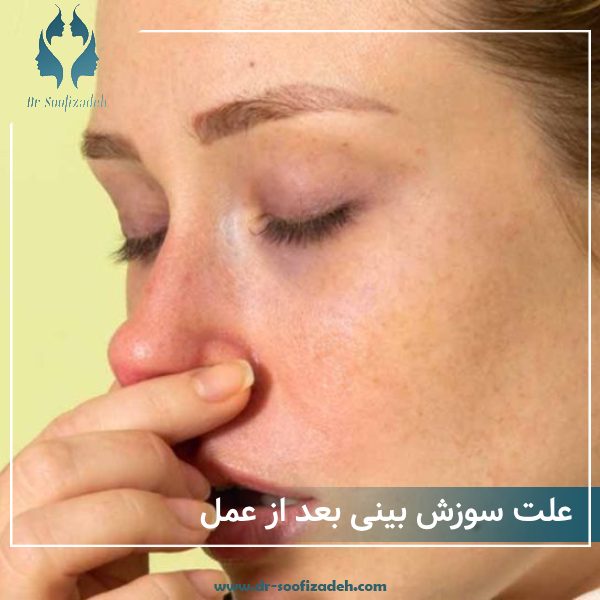 علت سوزش بینی بعد از عمل + پیشگیری و درمان سوزش بینی عمل شده