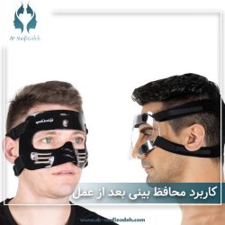 عکس محافظ بینی بعد از عمل